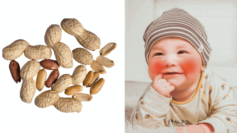 baby peanut allergy reaction