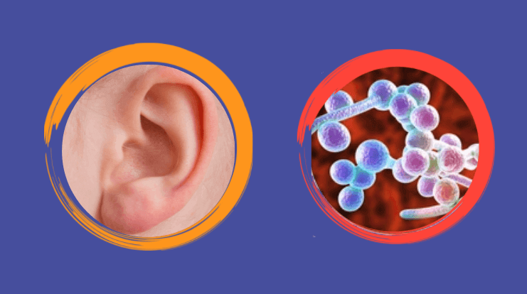 fungal infection in ear
