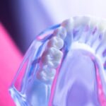 Reclaim Your Perfect Smile with The Help of a Cosmetic Dentist 