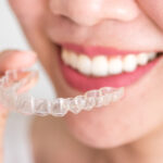 A Guide to Finding the Best Invisalign Dentist in Revesby 